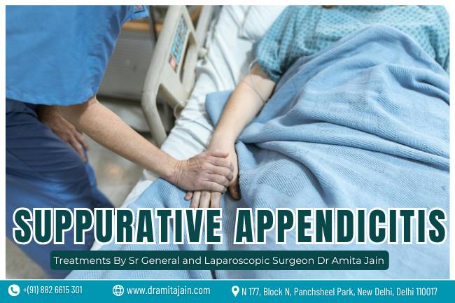 Dr Amita Jain leading surgeon for Suppurative Appendicitis
